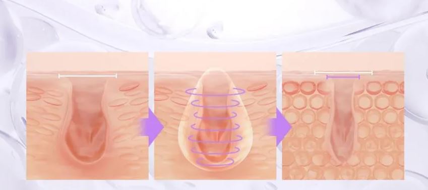 New Formula BIOHEAL BOH Probioderm 3D Lifting Cream 50mL South Korea K-Beauty